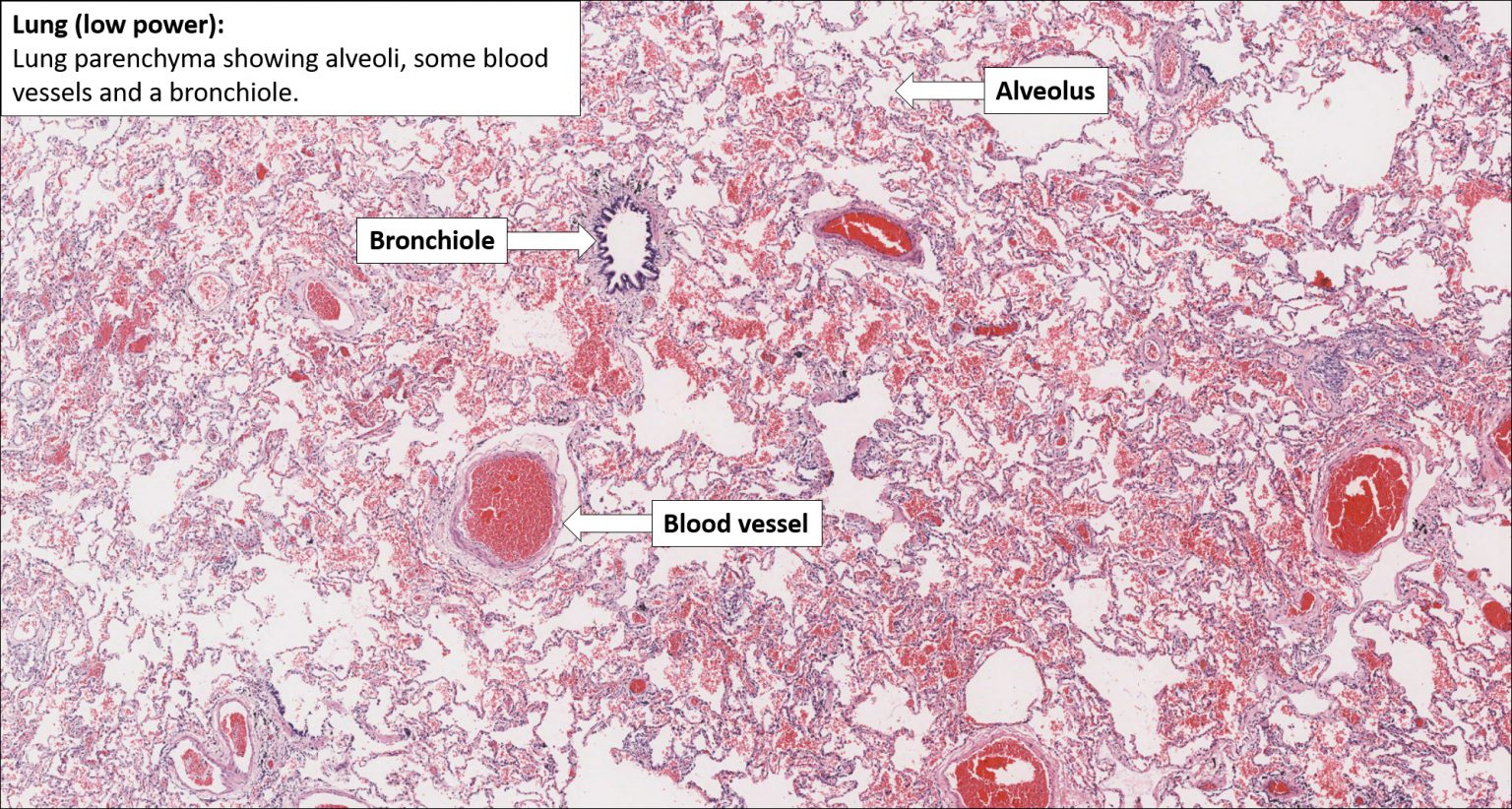 Lung Normal Histology NUS Pathweb NUS Pathweb