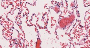 Lung Normal Histology Nus Pathweb Nus Pathweb