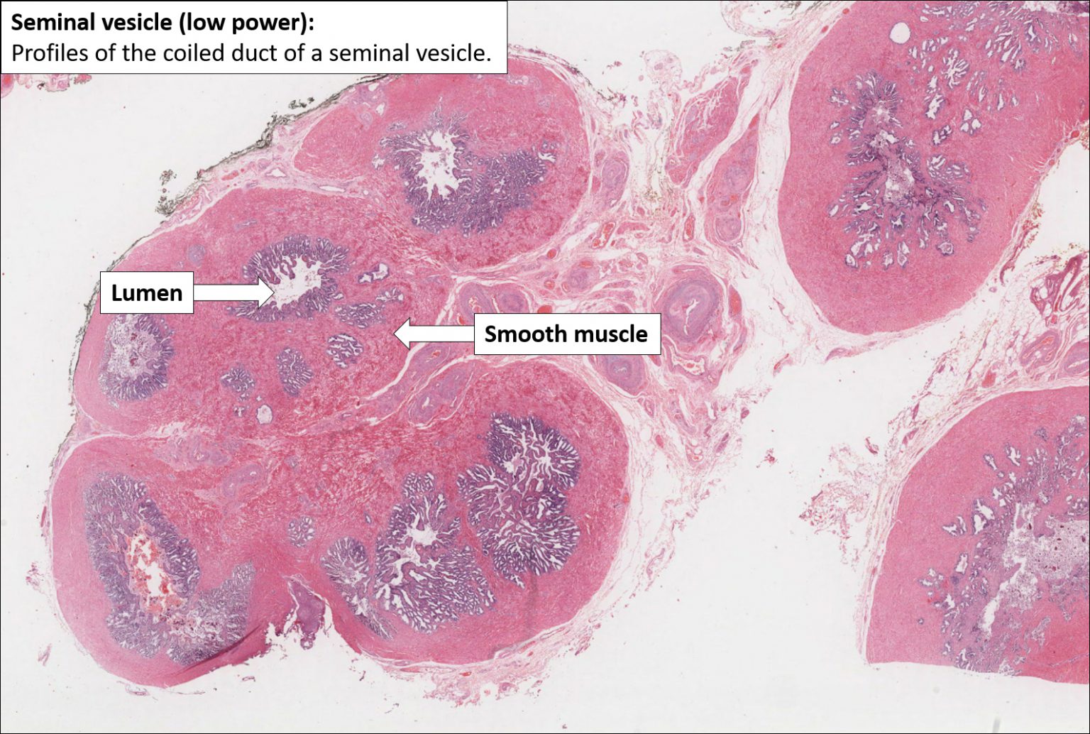 Seminal Vesicle Normal Histology NUS Pathweb NUS Pathweb