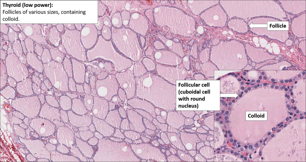 Thyroid Normal Histology Nus Pathweb Nus Pathweb