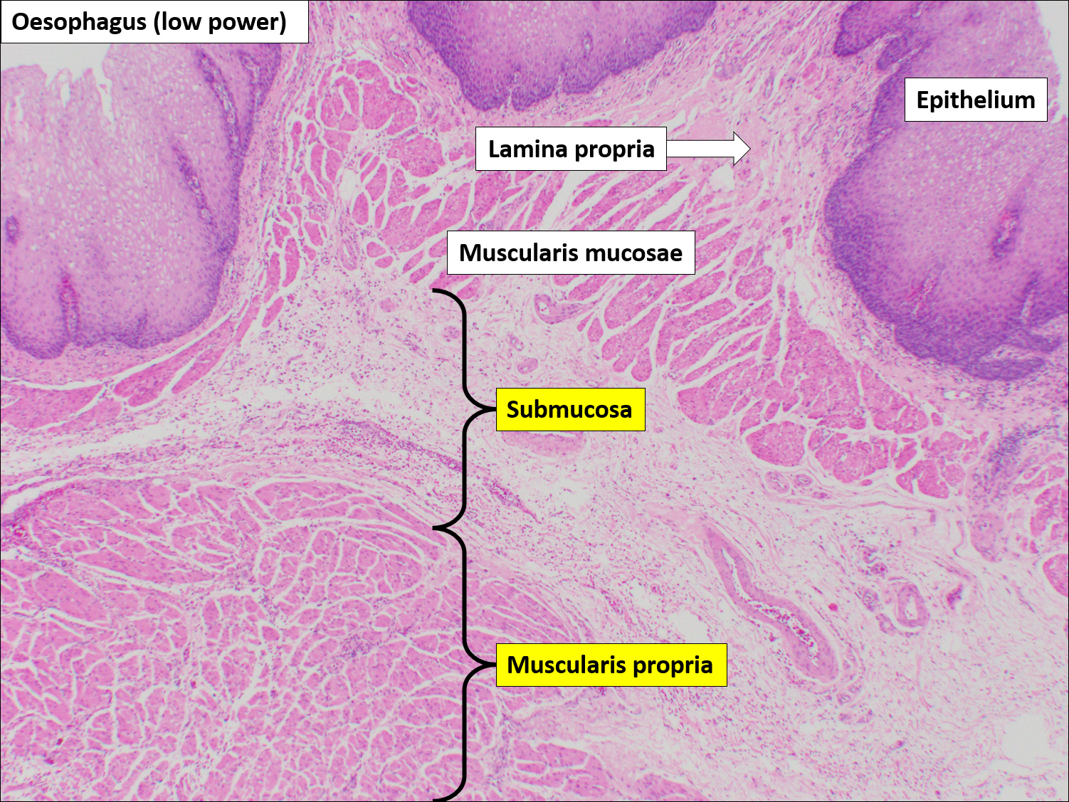 Esophagus Histology Diagram