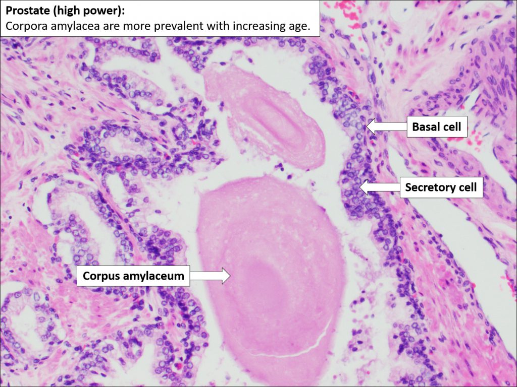 Prostate Normal Histology Nus Pathweb Nus Pathweb