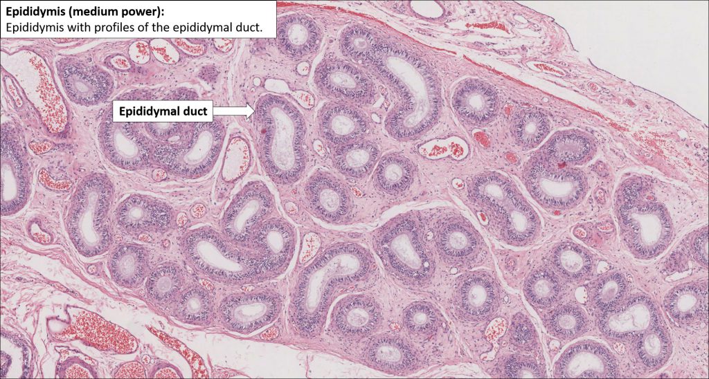 Testis And Epididymis Normal Histology Nus Pathweb Nus Pathweb