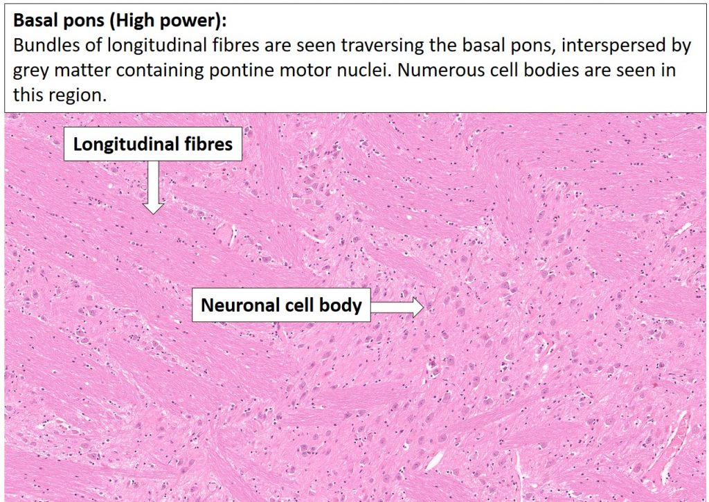 Brain Pons NUS Pathweb NUS Pathweb