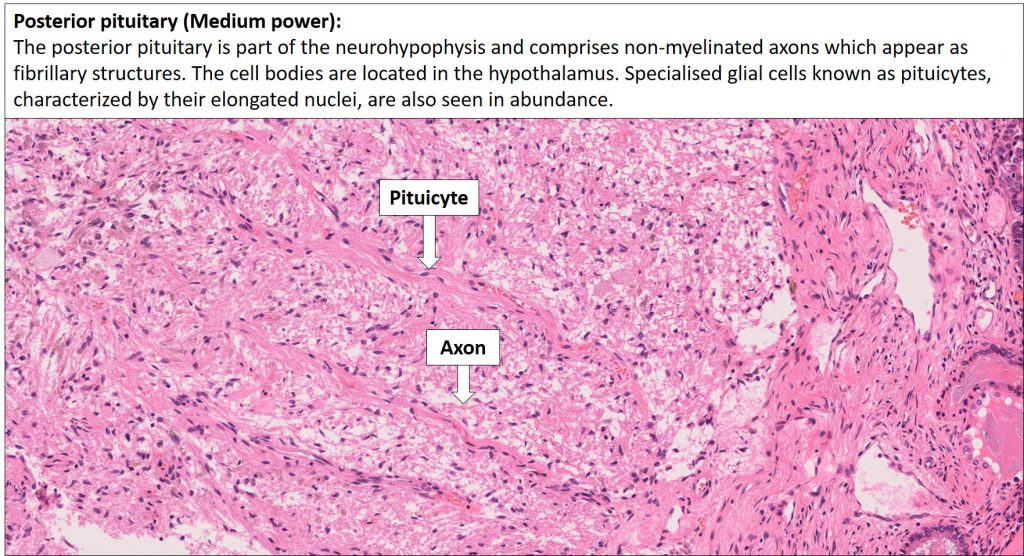 Brain Pituitary Nus Pathweb Nus Pathweb