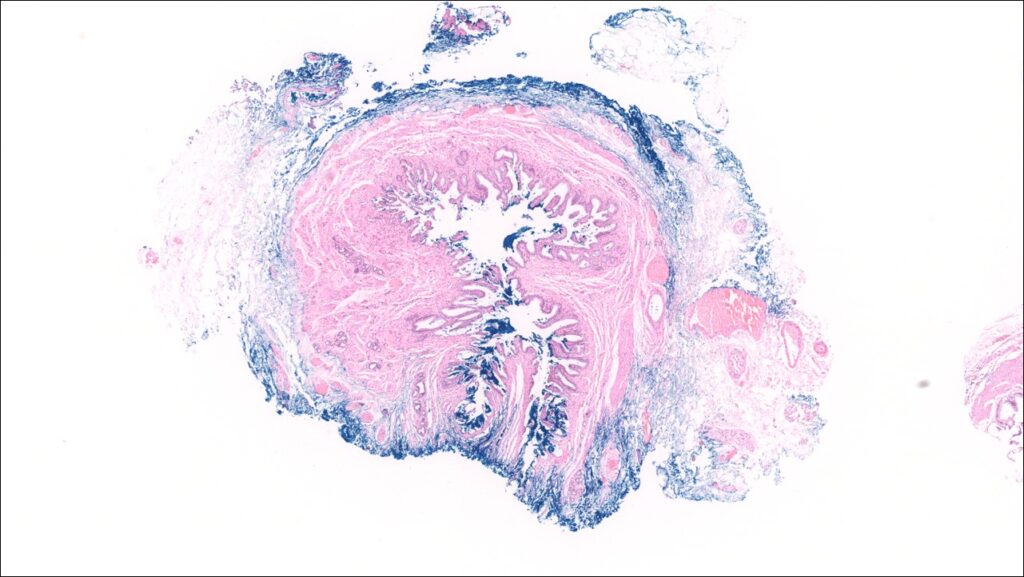 Gallbladder Normal Histology NUS Pathweb NUS Pathweb