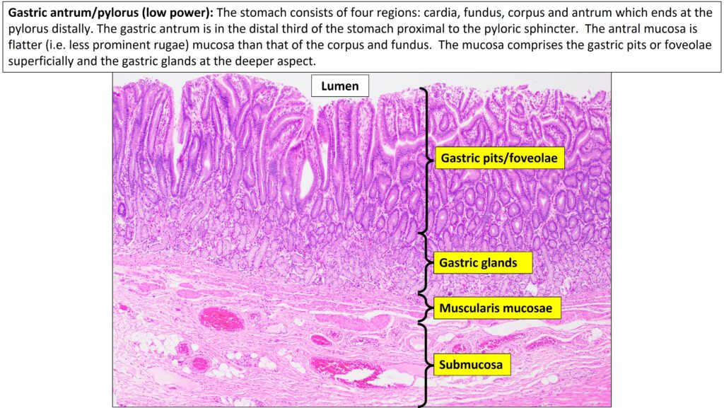 Stomach Normal Histology Nus Pathweb Nus Pathweb