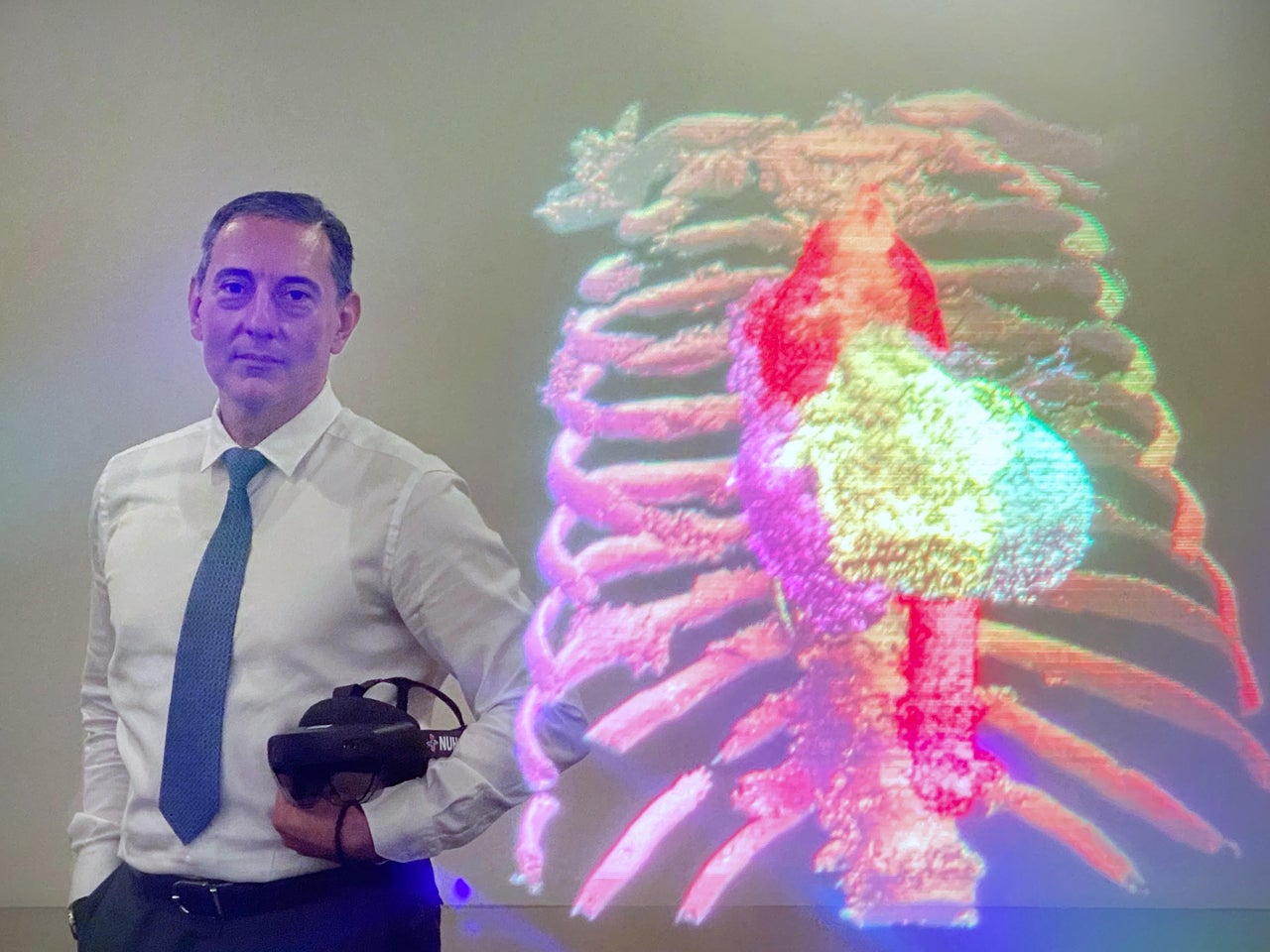 ccheart/ST20220104_202247977983/Ng Sor Luan/

(L-R)

·       Dr Gao Yujia

Associate Consultant

Division of Hepatobiliary & Pancreatic Surgery

National University Hospital (NUH)

Dr Gao is also the programme lead for holomedicine at NUHS – You may refer to the attached media release issued in August 2021 for more info.

 

·       Dr Chang Guohao

Consultant

Division of Cardiac Adult Surgery

Department of Cardiac, Thoracic and Vascular Surgery

National University Heart Centre, Singapore (NUHCS)

 

·       A/Prof Theodoros Kofidis

Head & Senior Consultant

Department of Cardiac, Thoracic and Vascular Surgery

National University Heart Centre, Singapore (NUHCS)

 

·       Ng Kian Wei

Data Scientist

AIO Innovation Office

National University Health System (NUHS)

 

·       Dr Ilias Skaltsiotis

Clinical Fellow

Division of Cardiac Adult Surgery

Department of Cardiac, Thoracic and Vascular Surgery

National University Heart Centre, Singapore (NUHCS)


A group of surgeons from NUH recently performed the first holography-guided heart surgery in Singapore. Using holographic visors, a 3D hologram of a patient’s 3D CT scan is projected into space and superimposed onto the patient’s chest during surgery. This tech may be able to provide surgeons with the opportunity to familiarise with the patient’s anatomy, chart a course in the patient’s heart valves or through the blood vessels, allowing surgeons to better understand the complexities of the patient’s anatomy, particularly impactful in paediatric patients with inherited anomalies and congenital heart defects.