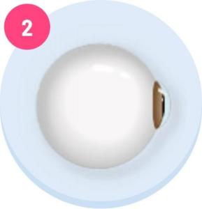 Photoreceptors detect light in the retina. 