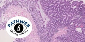 Pathweb education on medicine and medical science on pathology