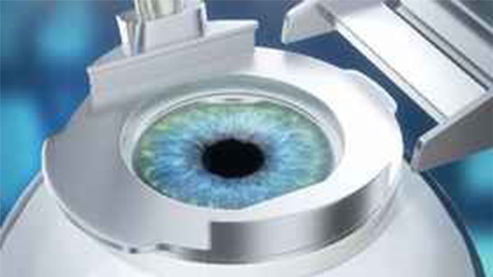 Refractive Surgery (LASIK) - Department of Ophthalmology, NUS Yong Loo Lin  School of Medicine
