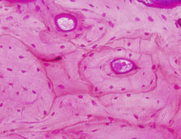 Resin Embedded Undecalcified Pig Bone - Methylene Blue Basic Fuchsin