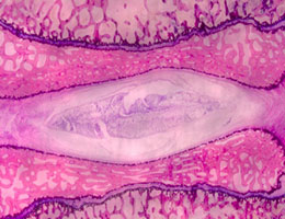 Resin Embedded Undecalcified Pig Intervertebral Disc - Methylene Blue Basic Fuchsin