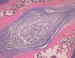 Rabbit Intervertebral Disc - H & E