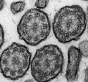 Cilia Formation 3 by Mdm Mary Chu