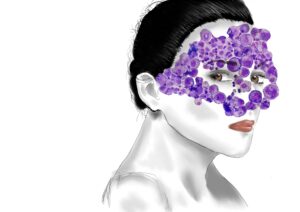 Lady Wearing Mask made of Metastatic Carcinoma from Peritoneal Fluid by Mr Roy Haiqel