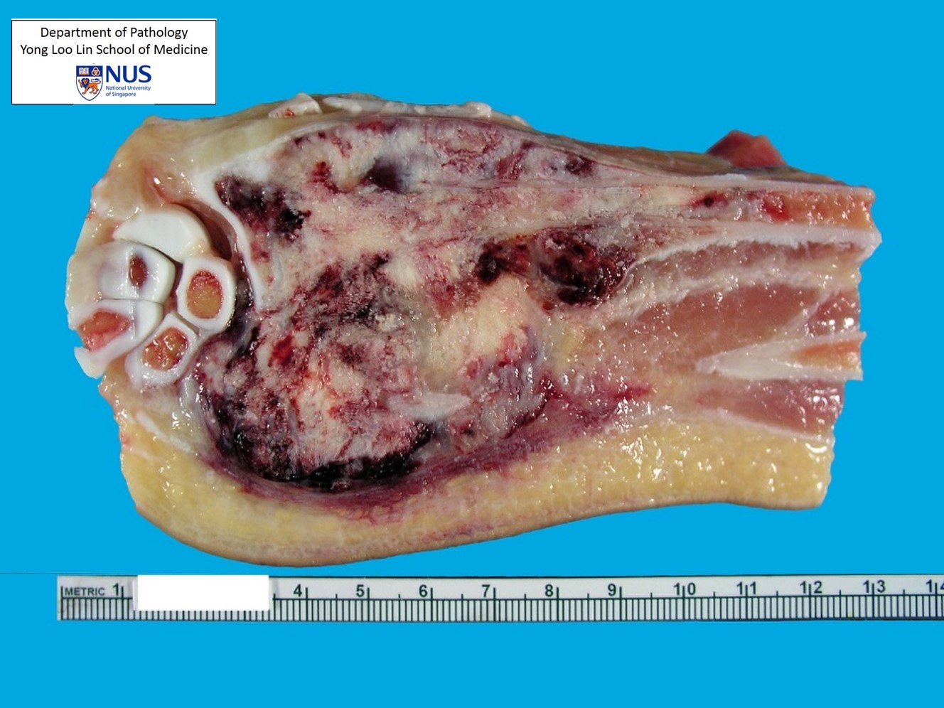Gross-bone-2l1412g
