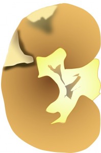 Kidney-210tfx3-198x300