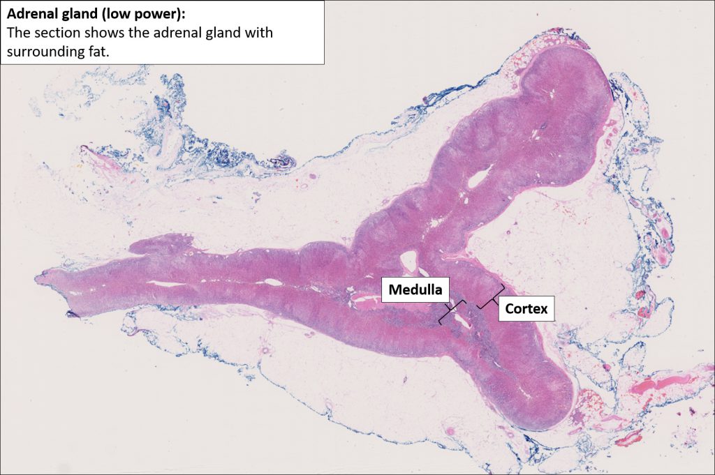 Adrenal Normal Histology Nus Pathweb Nus Pathweb 