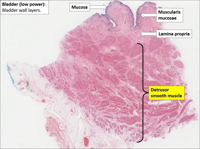 Bladder Normal Histology NUS Pathweb NUS Pathweb