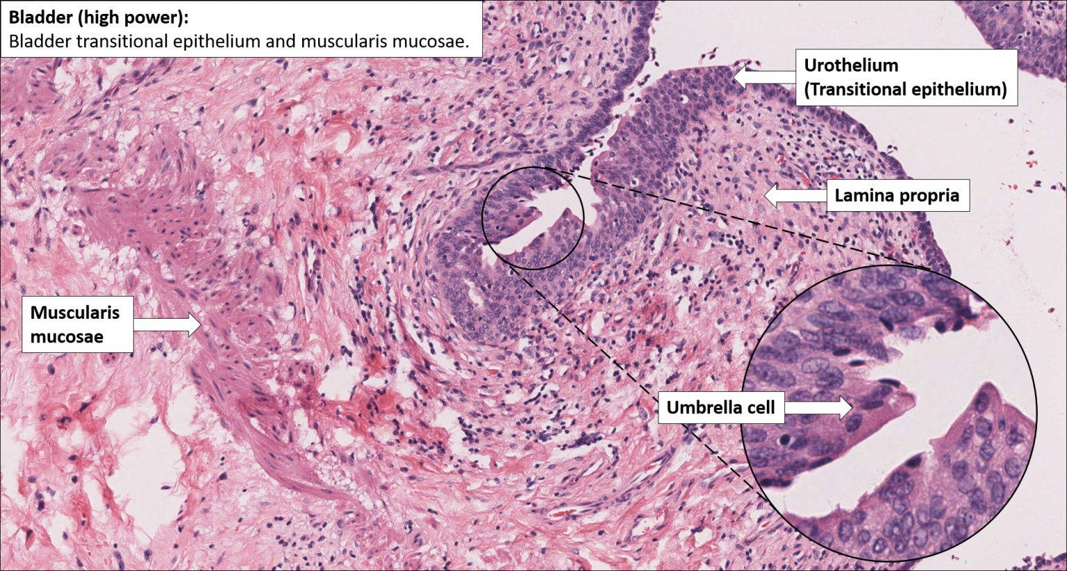 Bladder – Normal Histology – NUS Pathweb :: NUS Pathweb