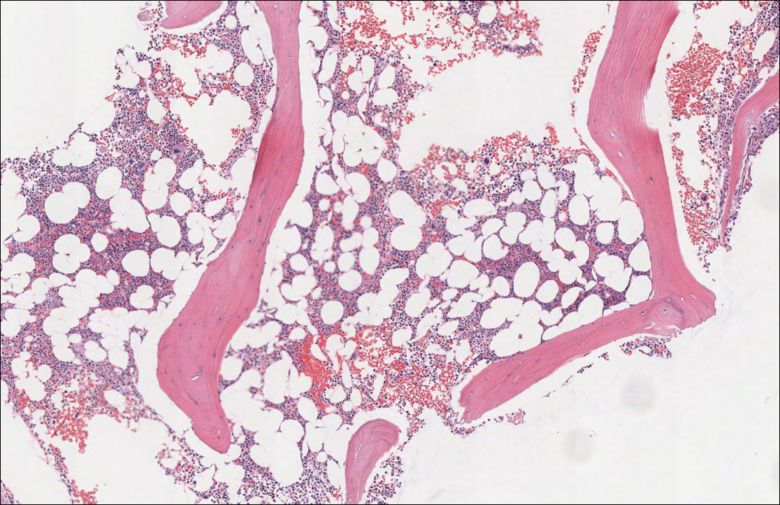 Bone Marrow – Normal Histology – NUS Pathweb :: NUS Pathweb