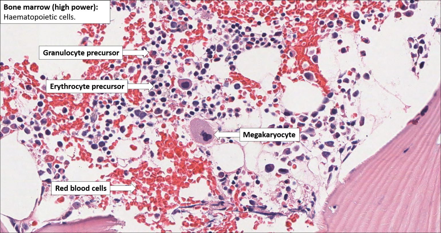 Bone Marrow Normal Histology NUS Pathweb NUS Pathweb