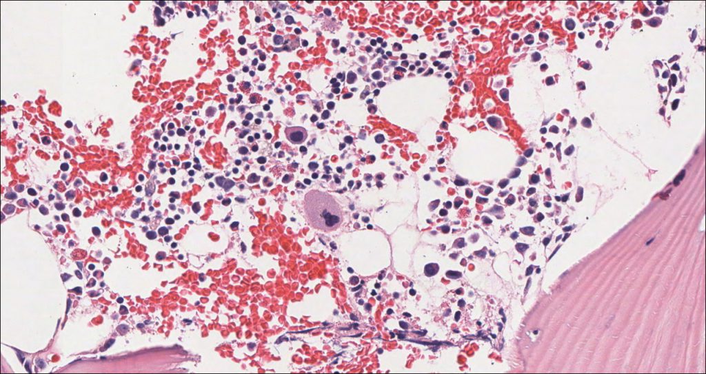 Bone Marrow Normal Histology Nus Pathweb Nus Pathweb