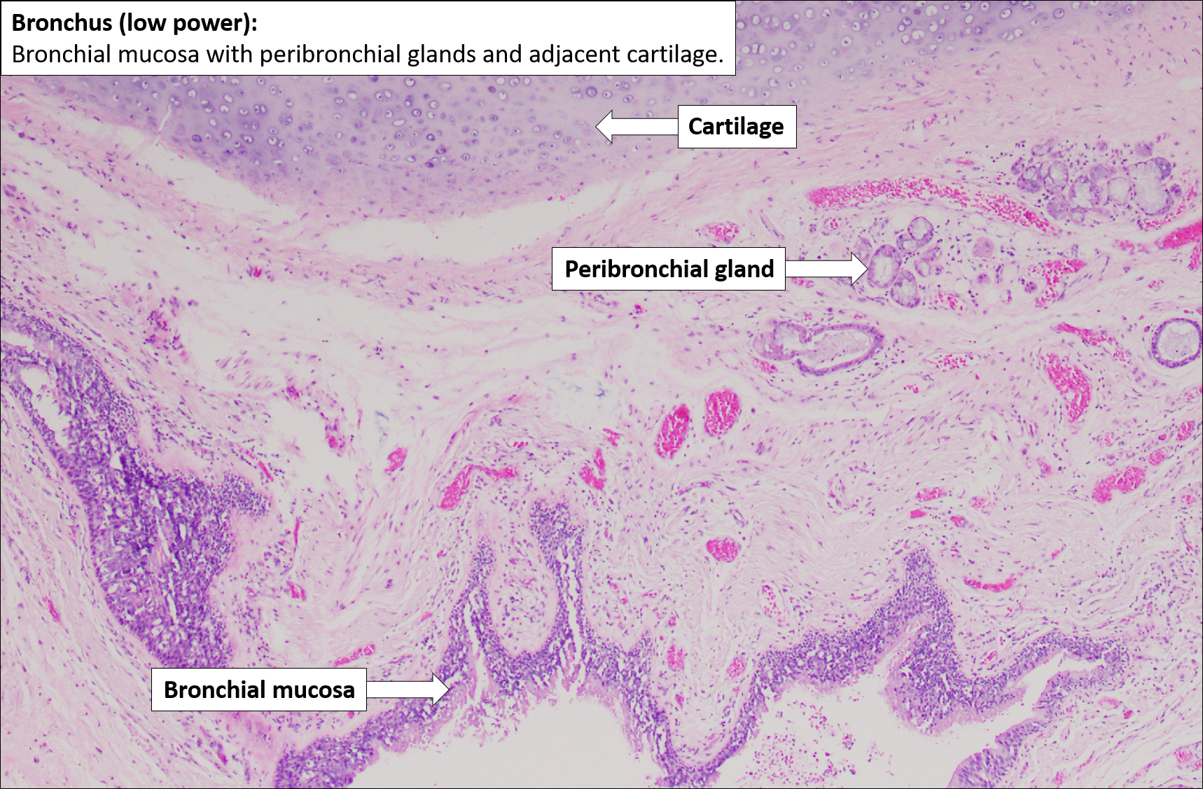 Bronchus – Normal Histology – NUS Pathweb