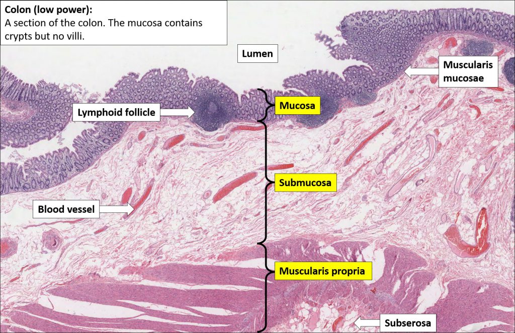 Colon – Normal Histology – NUS Pathweb :: NUS Pathweb