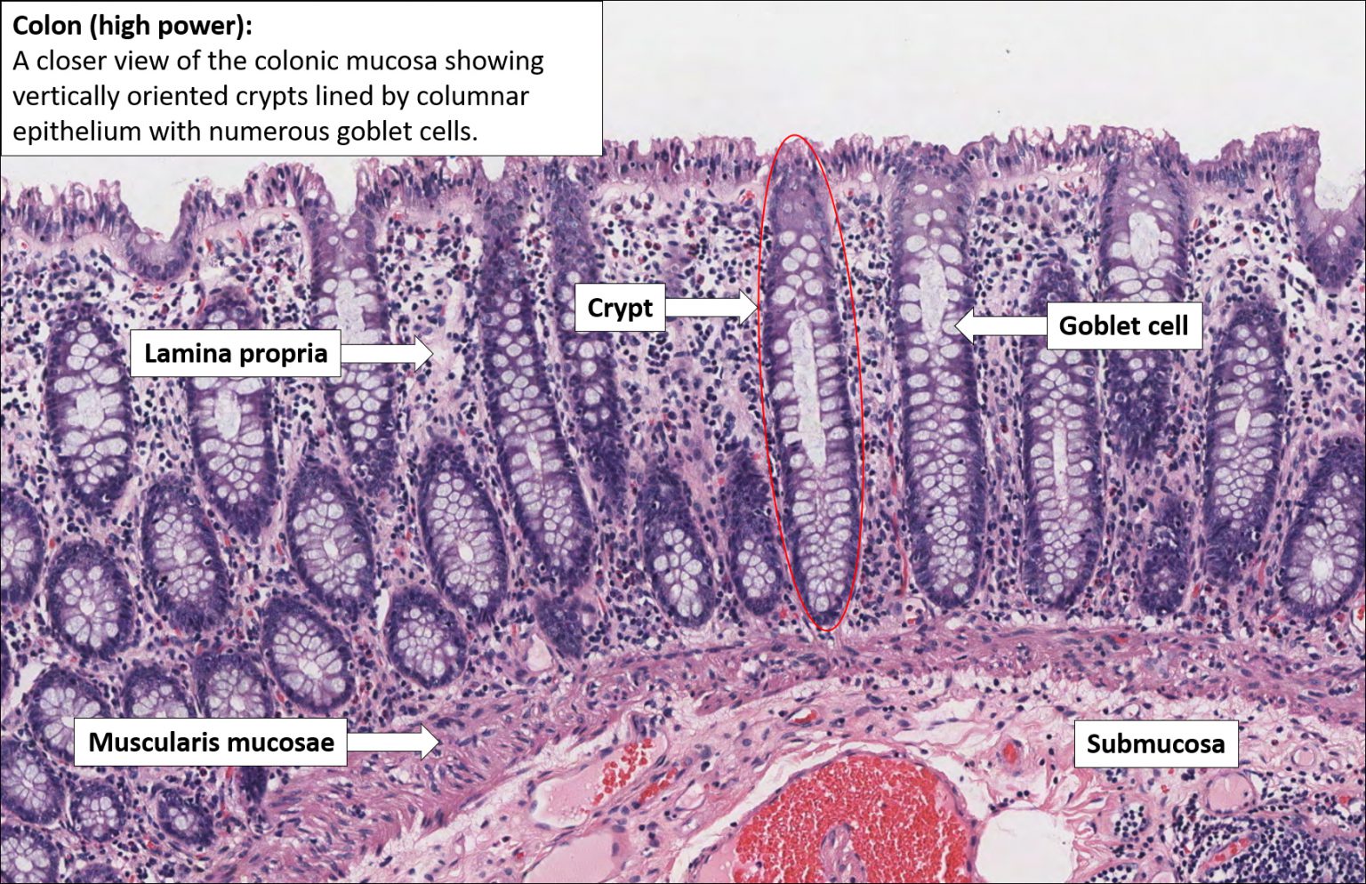 Colon Histology Slide With Labeled Diagram Anatomylearner The | My XXX ...