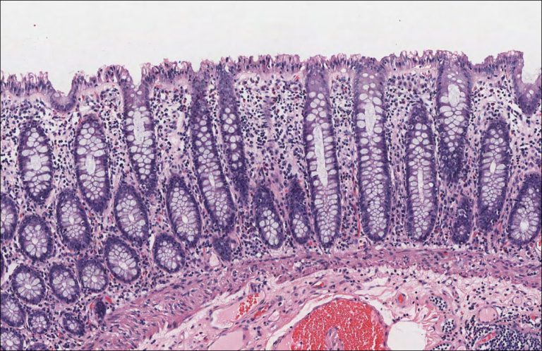 Colon – Normal Histology – NUS Pathweb :: NUS Pathweb