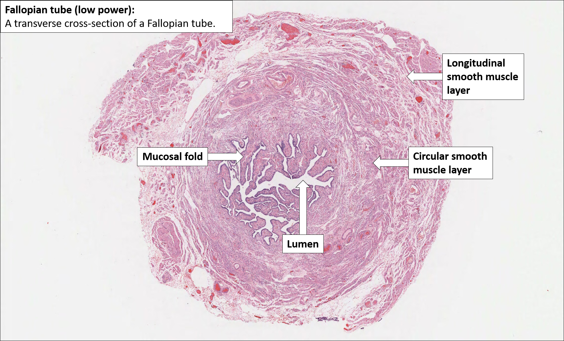 fallopian tube histology labeled