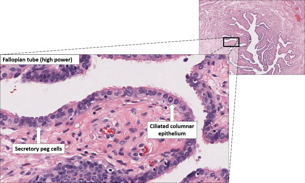 Fallopian Tube Normal Histology Nus Pathweb Nus Pathweb 0363