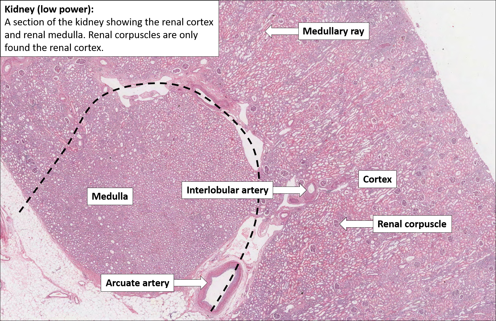 Kidney Normal Histology NUS Pathweb
