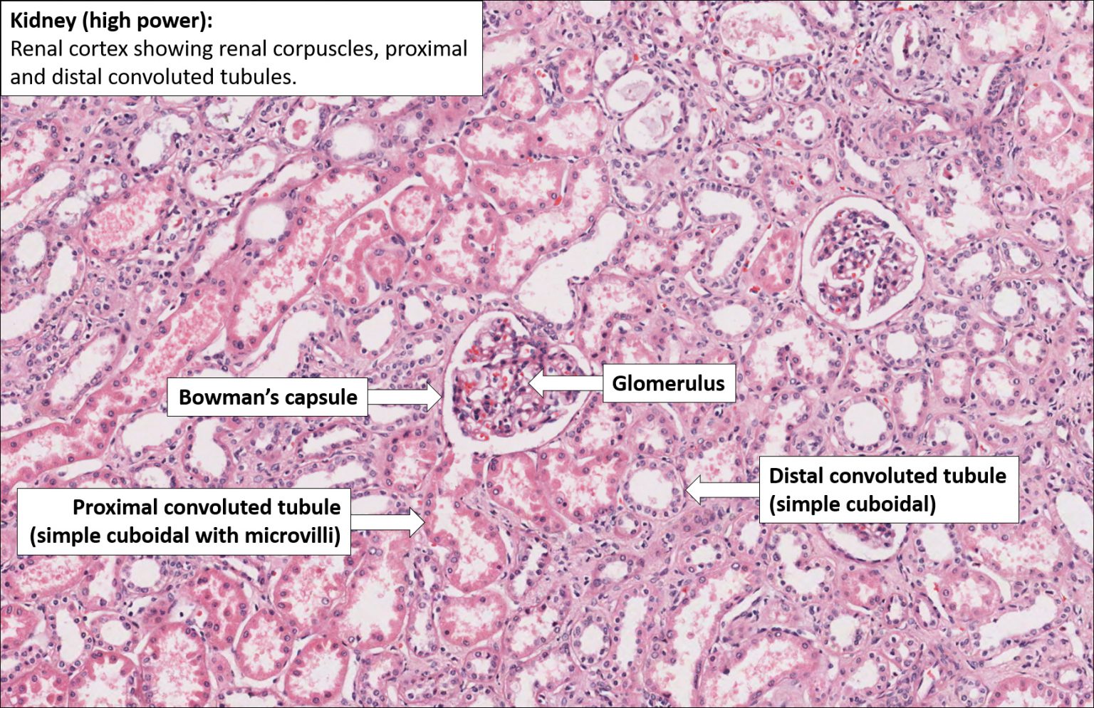 Kidney – Normal Histology – NUS Pathweb :: NUS Pathweb