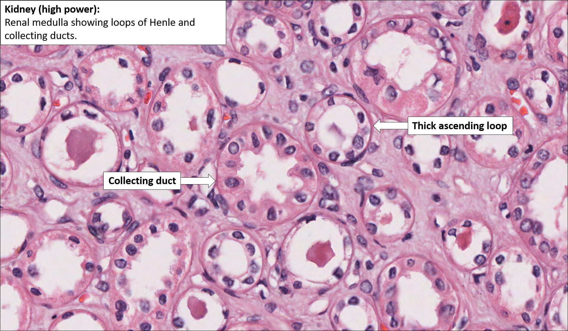 Kidney Histology Labeled Renal Corpuscle 2 Kidney Histology Labeled Renal Corpuscle 2