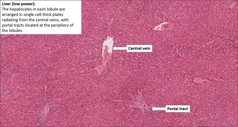 Liver – Normal Histology – NUS Pathweb :: NUS Pathweb