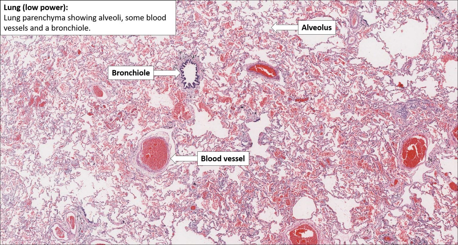 Lung Normal Histology NUS Pathweb NUS Pathweb Lung Normal Histology NUS Pathweb NUS Pathweb
