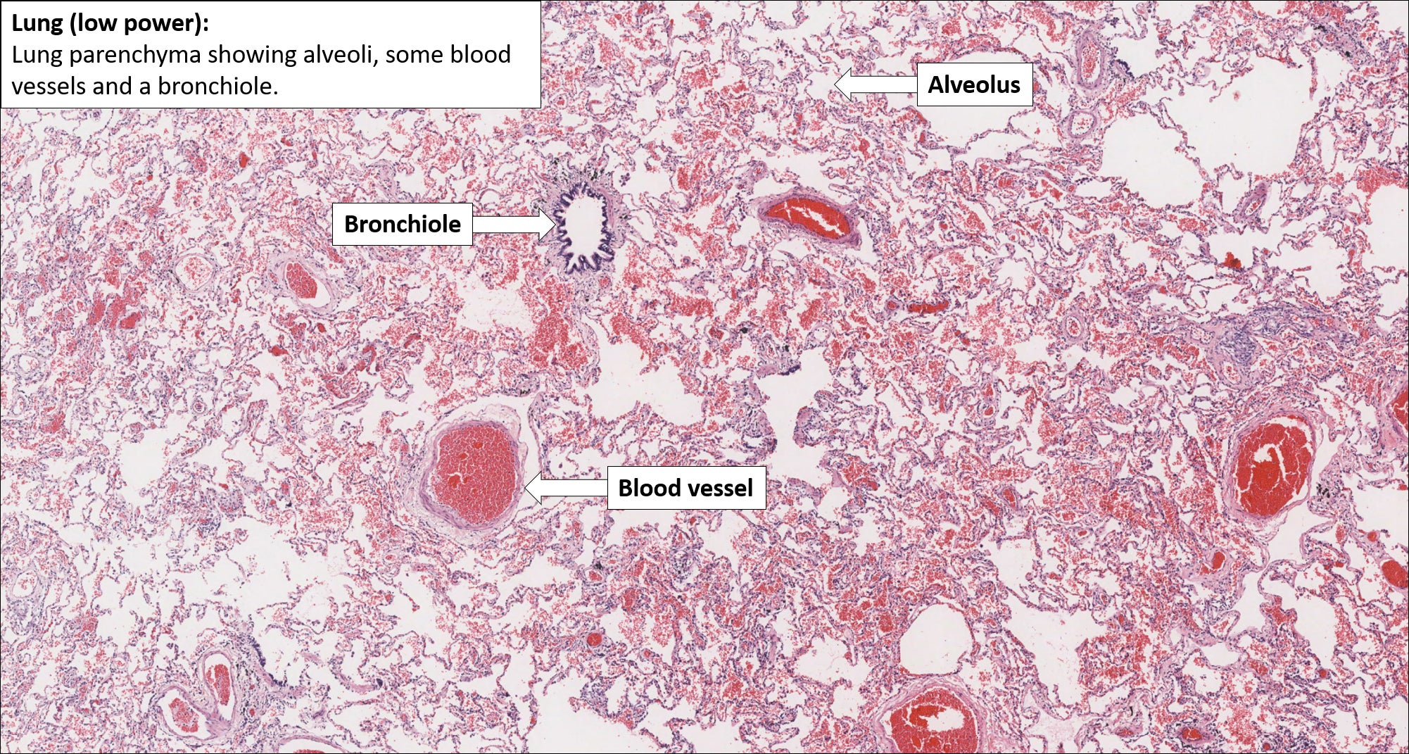 Lung Histology Panel Sham Shows The Histology Of A Normal FK866 A Lung Histology Panel Sham Shows The Histology Of A Normal FK866 A