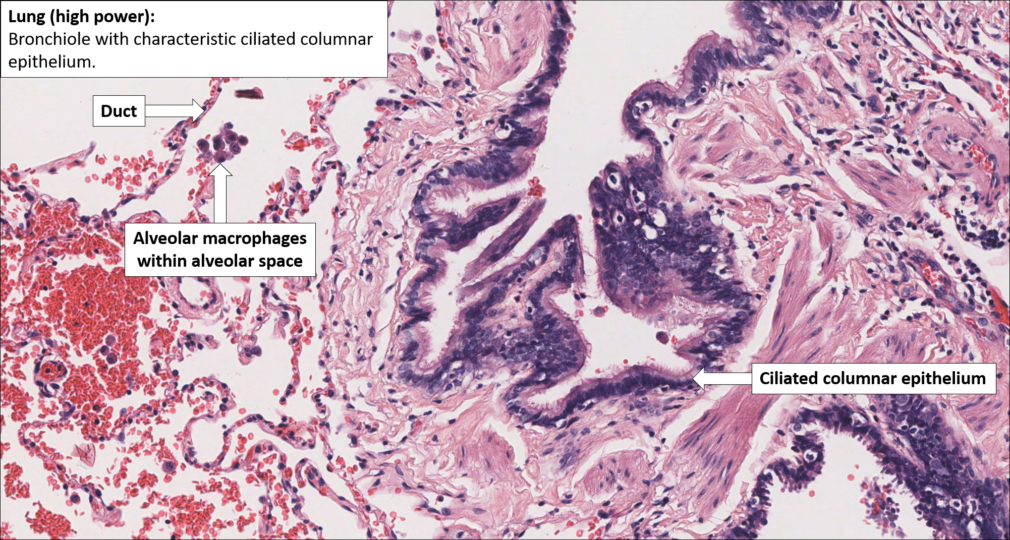 alveolar macrophage histology
