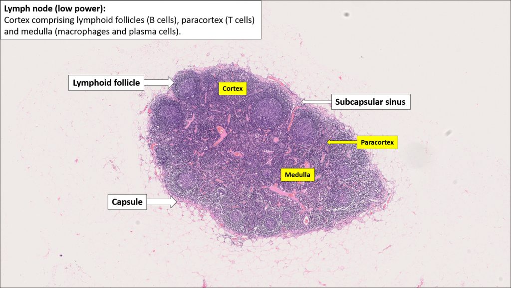 Lymph Node Normal Histology Nus Pathweb Nus Pathweb