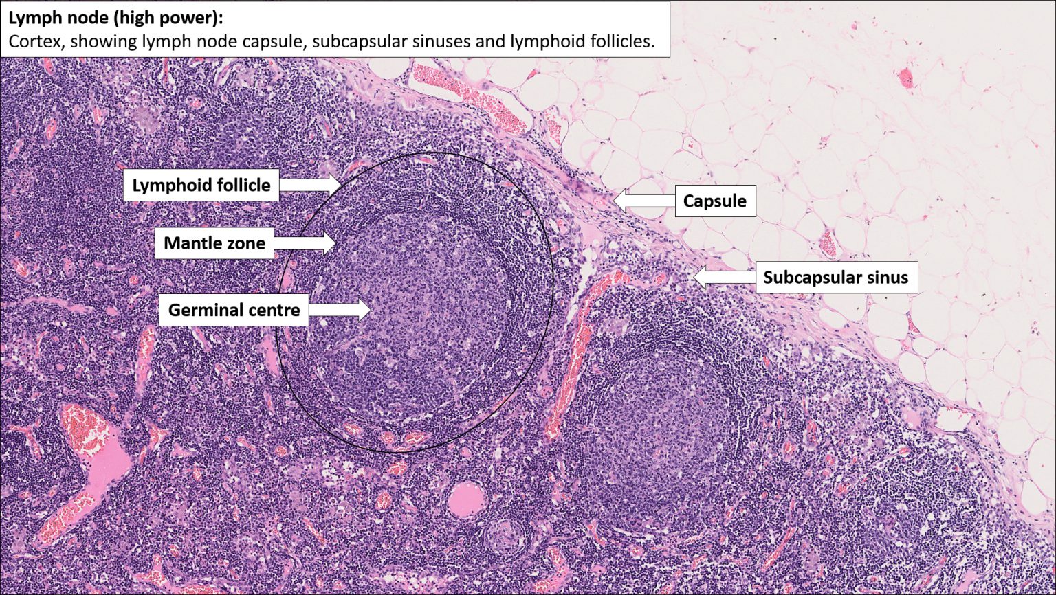 Lymph Node – Normal Histology – Nus Pathweb