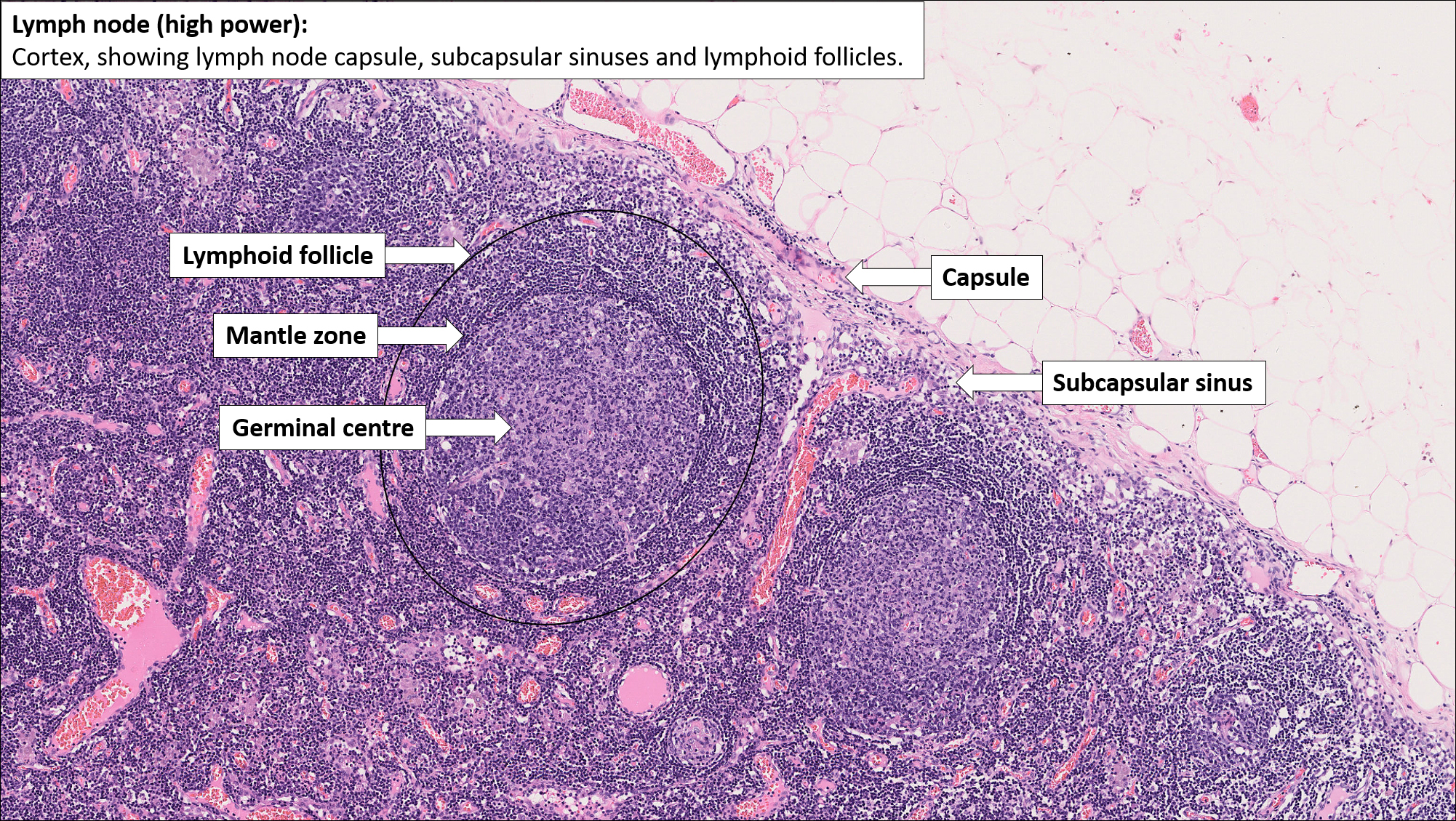Lymph Node – Normal Histology – NUS Pathweb :: NUS Pathweb