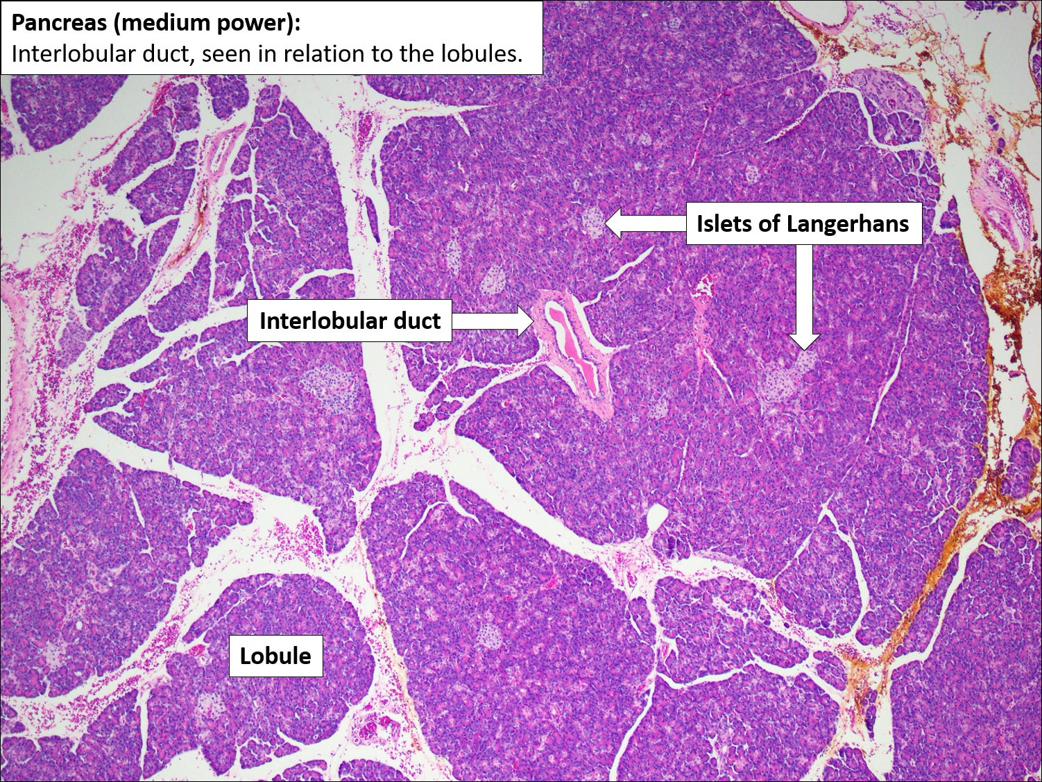 Pancreas Normal Histology NUS Pathweb NUS Pathweb Pancreas Normal Histology NUS Pathweb NUS Pathweb