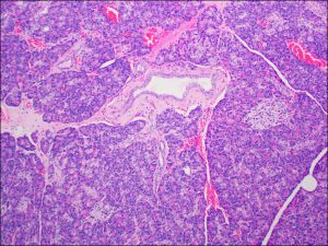 Pancreas – Normal Histology – NUS Pathweb :: NUS Pathweb