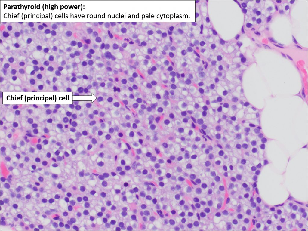 Parathyroid Normal Histology Nus Pathweb Nus Pathweb