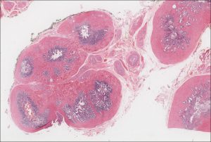 Seminal Vesicle – Normal Histology – NUS Pathweb :: NUS Pathweb