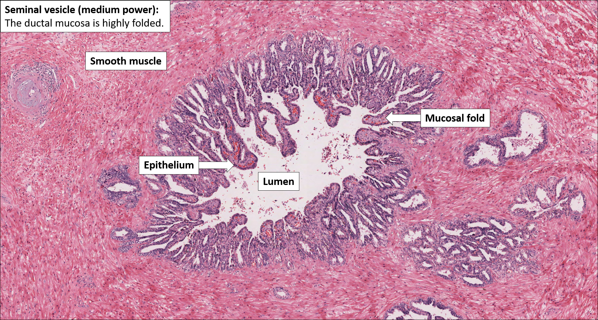 Seminal vesicle – Normal Histology – NUS Pathweb