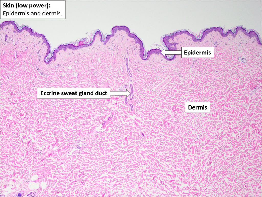 Skin Normal Histology Nus Pathweb Nus Pathweb